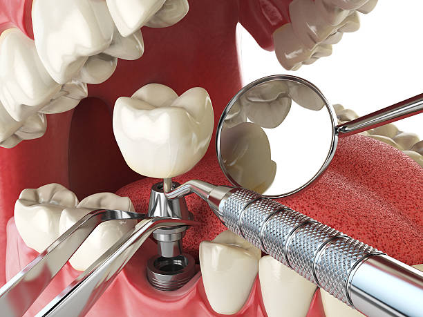 Best Emergency Treatment for Jaw Pain or Injury in Patrick Af, FL